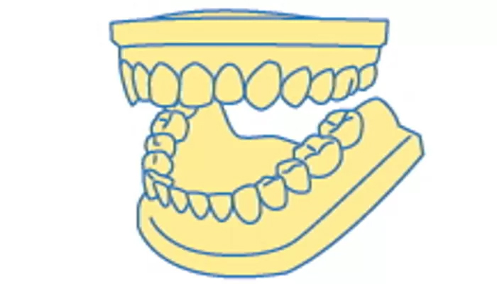 歯ぎしりの治療の流れ